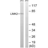Western blot analysis of extracts from 3T3 cells, treated with PMA (125ng/ml, 30mins), using LIMK2 (Ab-283) antibody. Western blot analysis of extracts from 3T3 cells, treated with PMA (125ng/ml, 30mins), using LIMK2 (Ab-283) antibody.