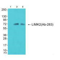 Western blot analysis of extracts from 293 cells (Lane 2) and cos-7 cells (Lane 3), using LIMK2 (Ab-283) antiobdy. The lane on the left is treated with synthesized peptide.