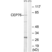 Western blot analysis of extracts from 3T3 cells, using CEP76 antibody. Western blot analysis of extracts from 3T3 cells, using CEP76 antibody.