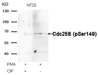 Western blot analysis of extracts from HT29 cells, treated with PMA or calf intestinal phosphatase (CIP), using Cdc25B (Phospho-Ser149) Antibody.