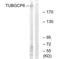 Western blot analysis of extracts from COLO cells, using TUBGCP6 antibody. Western blot analysis of extracts from COLO cells, using TUBGCP6 antibody.