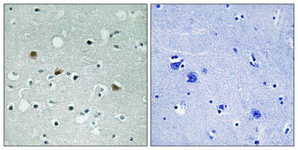 Immunohistochemical analysis of paraffin-embedded human brain tissue using LATS1/2 (Phospho-Thr1079/1041) antibody (left)or the same antibody preincubated with blocking peptide (right). Immunohistochemical analysis of paraffin-embedded human brain tissue using LATS1/2 (Phospho-Thr1079/1041) antibody (left)or the same antibody preincubated with blocking peptide (right).