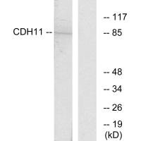 Western blot analysis of extracts from Jurkat cells, using CDH11 antibody. Western blot analysis of extracts from Jurkat cells, using CDH11 antibody.