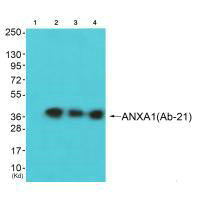 Western blot analysis of extracts from JK cells (Lane 2), K562 cells (Lane 3) and 293 cells (Lane 4), using ANXA1 (Ab-21) antiobdy. The lane on the left is treated with synthesized peptide.