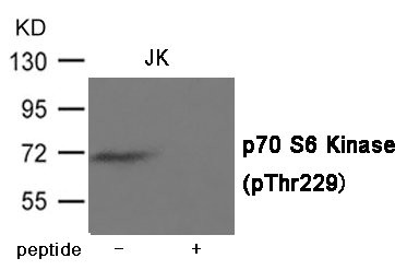 Western blot analysis of extracts from JK cells using p70 S6 Kinase (Phospho-Thr229) Antibody.The lane on the right is treated with the antigen-specific peptide. Western blot analysis of extracts from JK cells using p70 S6 Kinase (Phospho-Thr229) Antibody.The lane on the right is treated with the antigen-specific peptide.