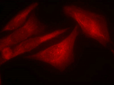 Immunofluorescence staining of methanol-fixed Hela cells using G3BP-1(Phospho-Ser232) Antibody.