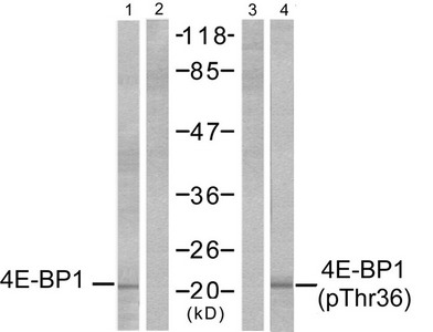 Western blot analysis of extracts from MDA-MB-435 cells, untreated or EGF-treated (200 ng/ml, 30min), using 4E-BP1 (Ab-36) antibody (Lane 1 and 2) and 4E-BP1 (phospho-Thr36) antibody (Lane 3 and 4). Western blot analysis of extracts from MDA-MB-435 cells, untreated or EGF-treated (200 ng/ml, 30min), using 4E-BP1 (Ab-36) antibody (Lane 1 and 2) and 4E-BP1 (phospho-Thr36) antibody (Lane 3 and 4).