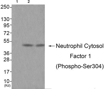 Western blot analysis of extracts from JK cells (Lane 2) and cos-7 cells (Lane 3), using Neutrophil Cytosol Factor 1 (Phospho-Ser304) Antibody. The lane on the left is treated with antigen-specific peptide. Western blot analysis of extracts from JK cells (Lane 2) and cos-7 cells (Lane 3), using Neutrophil Cytosol Factor 1 (Phospho-Ser304) Antibody. The lane on the left is treated with antigen-specific peptide.