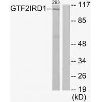 Western blot analysis of extracts from 293 cells, using GTF2IRD1 antibody. Western blot analysis of extracts from 293 cells, using GTF2IRD1 antibody.