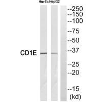Western blot analysis of extracts from HuvEc cells and HepG2 cells, using CD1E antibody. Western blot analysis of extracts from HuvEc cells and HepG2 cells, using CD1E antibody.