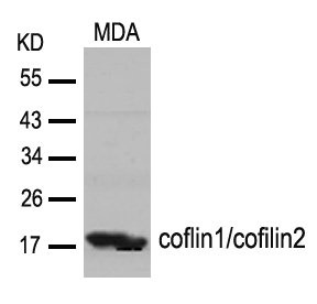 Western blot analysis of extracts from MDA cells using cofilin1/cofilin2(Ab-88) Antibody. Western blot analysis of extracts from MDA cells using cofilin1/cofilin2(Ab-88) Antibody.