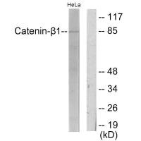 Western blot analysis of extracts from HeLa cells, using Catenin-beta1 antibody. Western blot analysis of extracts from HeLa cells, using Catenin-beta1 antibody.