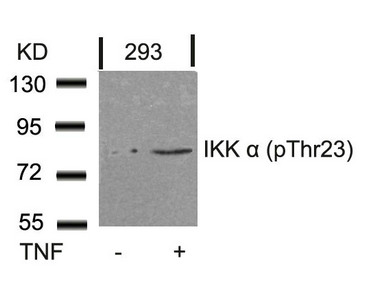 Western blot analysis of extracts from 293 cells untreated or treated with TNF using IKK a(Phospho-Thr23) Antibody. Western blot analysis of extracts from 293 cells untreated or treated with TNF using IKK a(Phospho-Thr23) Antibody.