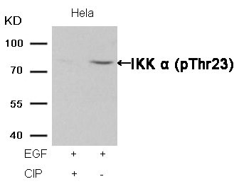 Western blot analysis of extracts from Hela cells, treated with EGF or calf intestinal phosphatase (CIP), using IKK alpha (Phospho-Thr23) Antibody.