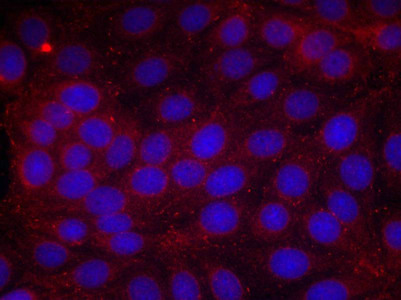 Immunofluorescence staining of methanol-fixed MCF cells using VEGFR2(Phospho-Tyr1214) Antibody.