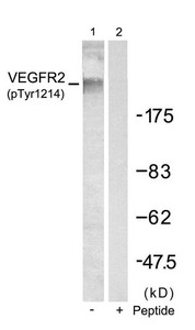 Western blot analysis of extracts from SKOV3 cells using VEGFR2(Phospho-Tyr1214) Antibody(Lane 1) and the same antibody preincubated with blocking peptide(Lane2). Western blot analysis of extracts from SKOV3 cells using VEGFR2(Phospho-Tyr1214) Antibody(Lane 1) and the same antibody preincubated with blocking peptide(Lane2).
