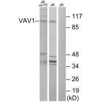 Western blot analysis of extracts from Jurkat cells, using VAV1 (Ab-174) antibody. Western blot analysis of extracts from Jurkat cells, using VAV1 (Ab-174) antibody.