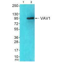 Western blot analysis of extracts from JK cells (Lane 2), using VAV1 (Ab-174) antiobdy. The lane on the left is treated with synthesized peptide.