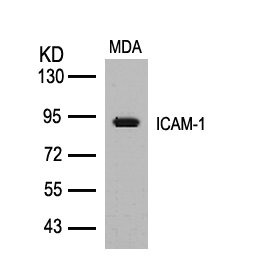 Western blot analysis of extracts from MDA cells using ICAM-1(Ab-512) Antibody. Western blot analysis of extracts from MDA cells using ICAM-1(Ab-512) Antibody.
