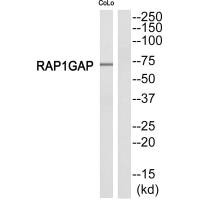 Western blot analysis of extracts from COLO205 cells, using RAP1GDS1 antibody. Western blot analysis of extracts from COLO205 cells, using RAP1GDS1 antibody.
