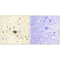 Immunohistochemistry analysis of paraffin-embedded human brain tissue using Ras-GRF1 antibody. Immunohistochemistry analysis of paraffin-embedded human brain tissue using Ras-GRF1 antibody.