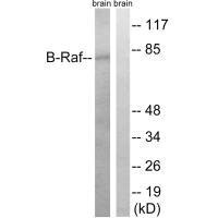 Western blot analysis of extracts from rat brain cells, using B-Raf (Ab-753) antibody. Western blot analysis of extracts from rat brain cells, using B-Raf (Ab-753) antibody.