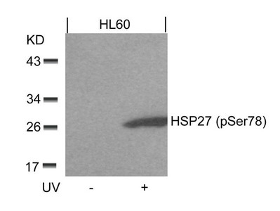 Western blot analysis of extracts from HL60 cells untreated or treated with UV using HSP27(Phospho-Ser78) Antibody. Western blot analysis of extracts from HL60 cells untreated or treated with UV using HSP27(Phospho-Ser78) Antibody.