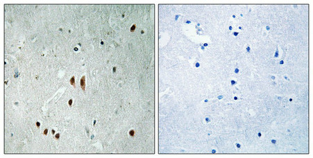 Immunohistochemical analysis of paraffin-embedded human brain tissue using CNOT2 (Phospho-Ser101) antibody (left)or the same antibody preincubated with blocking peptide (right). Immunohistochemical analysis of paraffin-embedded human brain tissue using CNOT2 (Phospho-Ser101) antibody (left)or the same antibody preincubated with blocking peptide (right).