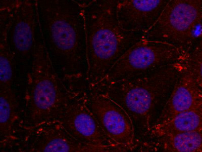 Immunofluorescence staining of methanol-fixed MCF cells using Her3/ErbB3(Ab-1289) Antibody. Immunofluorescence staining of methanol-fixed MCF cells using Her3/ErbB3(Ab-1289) Antibody.