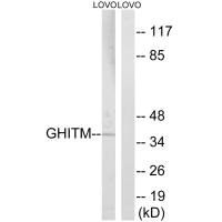 Western blot analysis of extracts from LOVO cells, using GHITM antibody. Western blot analysis of extracts from LOVO cells, using GHITM antibody.