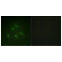 Immunofluorescence analysis of HeLa cells, using Smad1 (Ab-187) antibody.
