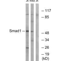 Western blot analysis of extracts from JK and K562 cells, using Smad1 (Ab-187) antibody. Western blot analysis of extracts from JK and K562 cells, using Smad1 (Ab-187) antibody.