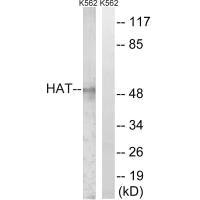 Western blot analysis of extracts from K562 cells, using HAT antibody. Western blot analysis of extracts from K562 cells, using HAT antibody.