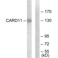 Western blot analysis of extracts from COLO205 cells, using CARD11 antibody. Western blot analysis of extracts from COLO205 cells, using CARD11 antibody.