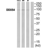 Western blot analysis of extracts from CoLo cells, 293 cells and JurKat cells, using DDX54 antibody. Western blot analysis of extracts from CoLo cells, 293 cells and JurKat cells, using DDX54 antibody.