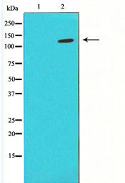 Western blot analysis on LOVO using HIF1a antibody ,The lane on the left is blocked with the antigen-specific peptide. Western blot analysis on LOVO using HIF1a antibody ,The lane on the left is blocked with the antigen-specific peptide.
