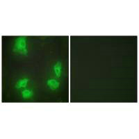 Immunofluorescence analysis of HeLa cells, using CDK5R1 antibody.
