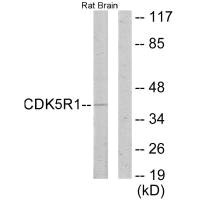 Western blot analysis of extracts from rat brain cells, using CDK5R1 antibody. Western blot analysis of extracts from rat brain cells, using CDK5R1 antibody.