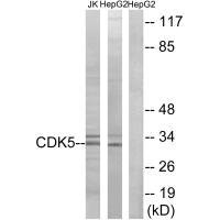 Western blot analysis of extracts from Jurkat cells and HepG2 cells, using CDK5 (Ab-15) antibody.