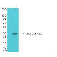 Western blot analysis of extracts from cos-7 cells (Lane 2), using CDK5 (Ab-15) antiobdy. The lane on the left is treated with synthesized peptide.