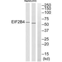 Western blot analysis of extracts from HepG2 cells and LOVO cells, using EIF2B4 antibody. Western blot analysis of extracts from HepG2 cells and LOVO cells, using EIF2B4 antibody.