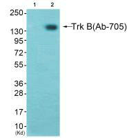 Western blot analysis of extracts from K562 cells (Lane 2), using Trk B (Ab-705) antiobdy. The lane on the left is treated with synthesized peptide. Western blot analysis of extracts from K562 cells (Lane 2), using Trk B (Ab-705) antiobdy. The lane on the left is treated with synthesized peptide.