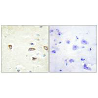 Immunohistochemistry analysis of paraffin-embedded human brain tissue using MRCKB antibody.
