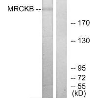 Western blot analysis of extracts from COLO cells, using MRCKB antibody. Western blot analysis of extracts from COLO cells, using MRCKB antibody.