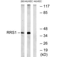 Western blot analysis of extracts from 293 cells and HuvEc cells, using RRS1 antibody. Western blot analysis of extracts from 293 cells and HuvEc cells, using RRS1 antibody.