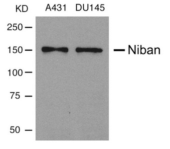 Western blot analysis of extracts from A431 and DU145 cells using Niban Antibody. Western blot analysis of extracts from A431 and DU145 cells using Niban Antibody.