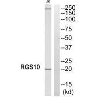 Western blot analysis of extracts from Jurkat cells, using RGS10 antibody. Western blot analysis of extracts from Jurkat cells, using RGS10 antibody.