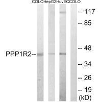 Western blot analysis of extracts from COLO cells, HepG2 cells and HUVEC cells, using PPP1R2 (Ab-44) antibody. Western blot analysis of extracts from COLO cells, HepG2 cells and HUVEC cells, using PPP1R2 (Ab-44) antibody.