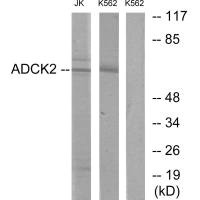 Western blot analysis of extracts from Jurkat cells and K562 cells, using ADCK2 antibody. Western blot analysis of extracts from Jurkat cells and K562 cells, using ADCK2 antibody.