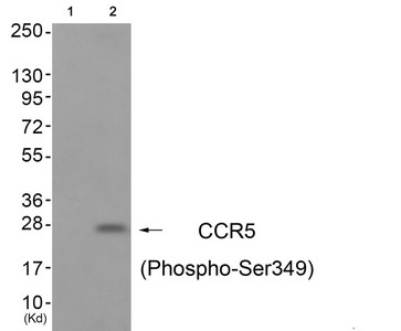 Western blot analysis of extracts from A549 cells (Lane 2), using CCR5 (Phospho-Ser349) Antibody. The lane on the left is treated with antigen-specific peptide. Western blot analysis of extracts from A549 cells (Lane 2), using CCR5 (Phospho-Ser349) Antibody. The lane on the left is treated with antigen-specific peptide.
